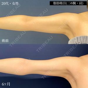 東京シンデレラ美容外科 大宮院の症例