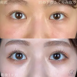AI Beauty Clinic （エーアイ美容クリニック） 田中 里佳医師の症例