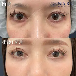 NARU Beauty Clinic 【ナルクリ】 地引 輔医師の症例