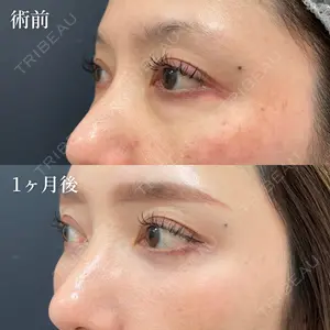 NARU Beauty Clinic 【ナルクリ】 地引 輔医師の症例