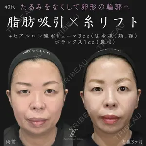 Zetith Beauty Clinic 福岡院 荻野 活医師の症例