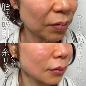 SK新宿歌舞伎町美容外科・歯科 高倉 光平医師の症例