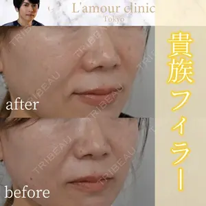 L‘amour clinic Tokyo【ラムールクリニック東京】の症例