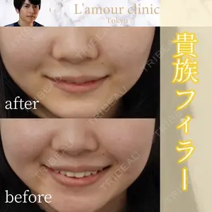 L‘amour clinic Tokyo【ラムールクリニック東京】の症例