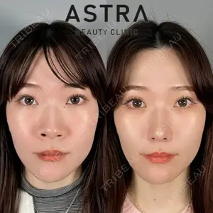 ASTRA BEAUTY CLINIC 塩満 惠子医師の症例