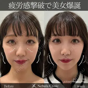 ネビュラクリニック 広島院の症例