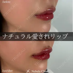 ネビュラクリニック 広島院の症例