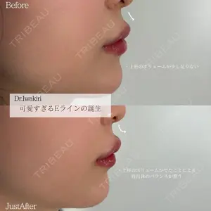 ネビュラクリニック 広島院の症例