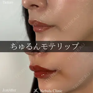 ネビュラクリニック 広島院の症例
