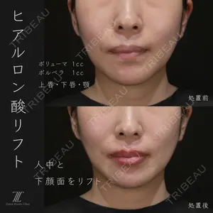 Zetith Beauty Clinic 福岡院 荻野 活医師の症例