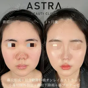 ASTRA BEAUTY CLINIC 塩満 惠子医師の症例