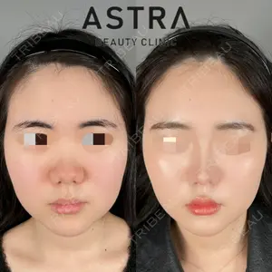 ASTRA BEAUTY CLINIC 塩満 惠子医師の症例