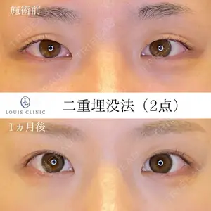 LOUIS CLINIC 二子玉川院【ルイクリニック】 小松 塁医師の症例