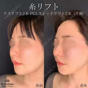 Brandnew Beauty Clinicの症例