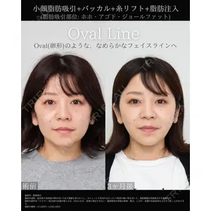 湘南美容クリニック Regno 銀座院 朝野 朋医師の症例