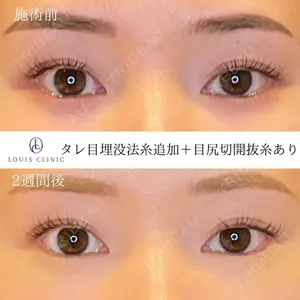 LOUIS CLINIC 二子玉川院【ルイクリニック】 小松 塁医師の症例