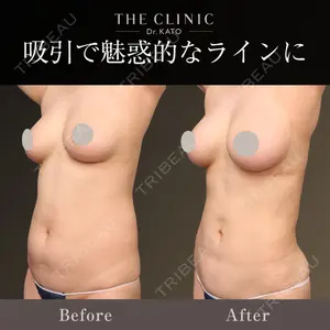 THE CLINIC（ザ・クリニック）東京院 加藤 敏次医師の症例