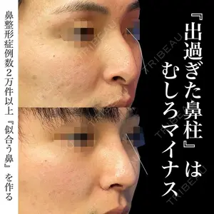 グローバルビューティークリニック 銀座院 理事長　杉崎　裕斗医師の症例