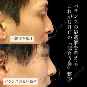 グローバルビューティークリニック 銀座院 理事長　杉崎　裕斗医師の症例