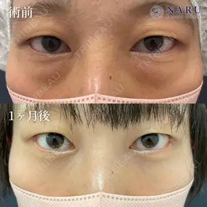 NARU Beauty Clinic 【ナルクリ】 地引 輔医師の症例