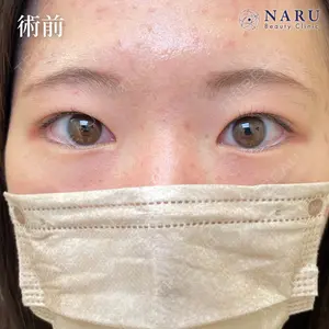 NARU Beauty Clinic 【ナルクリ】 地引 輔医師の症例