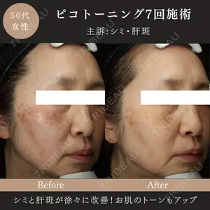 MIO CLINIC 梅田院の症例