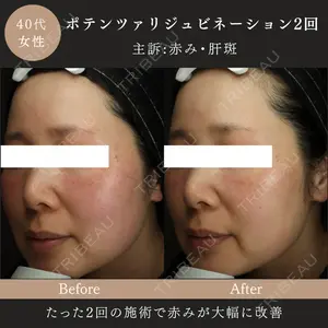 MIO CLINIC 梅田院の症例