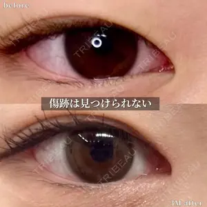 グローバルビューティークリニック 大阪院の症例