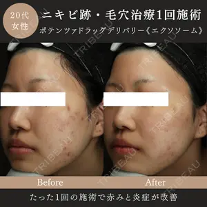 MIO CLINIC 梅田院の症例