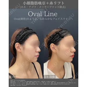 湘南美容クリニック 銀座院の症例