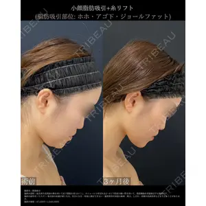 湘南美容クリニック 銀座院の症例