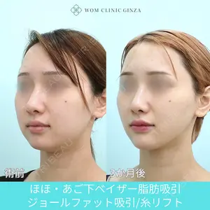 WOM CLINIC GINZA （ワム クリニック ギンザ） 深堀 純也医師の症例