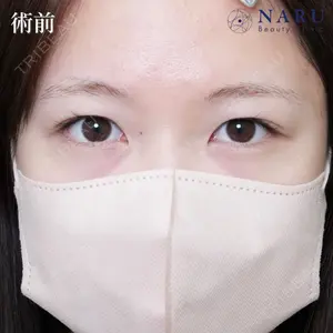 NARU Beauty Clinic 【ナルクリ】 石橋 成彦医師の症例