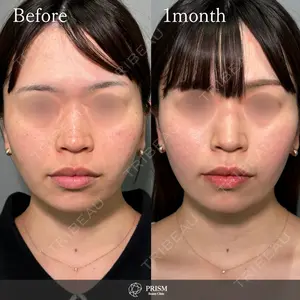 PRISM Beauty Clinic 畑山 知輝医師の症例