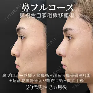 ジョウクリニック 銀座院 重本　譲医師の症例