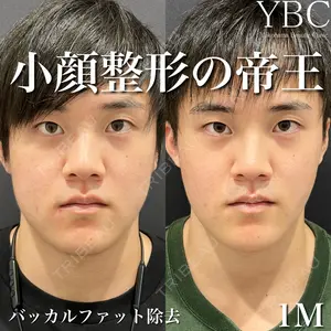 YBC横浜美容外科 大宮院 磯村 亮輔医師の症例