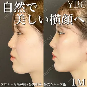 YBC横浜美容外科 大宮院 磯村 亮輔医師の症例