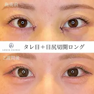 LOUIS CLINIC 二子玉川院【ルイクリニック】 小松 塁医師の症例