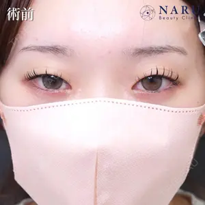 NARU Beauty Clinic 【ナルクリ】 石橋 成彦医師の症例