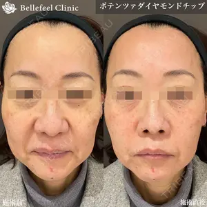 Bellefeel Clinic 代官山の症例