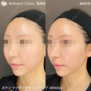 Bellefeel Clinic 代官山の症例