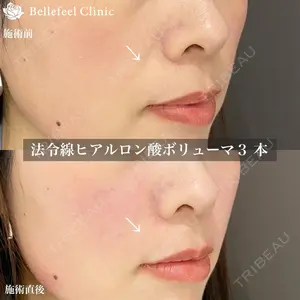 Bellefeel Clinic 代官山の症例