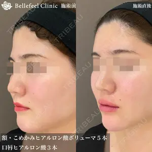 Bellefeel Clinic 代官山の症例