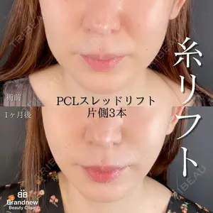 Brandnew Beauty Clinicの症例