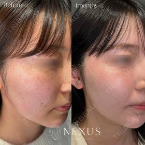 NEXUS CLINICの症例