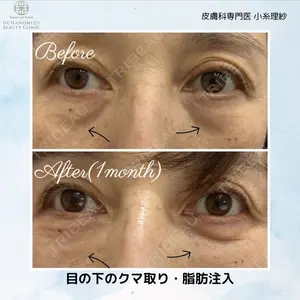 渋谷お茶の水美容形成クリニック 小糸 理紗医師の症例