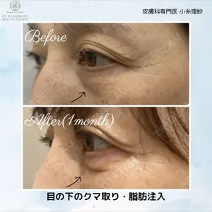 渋谷お茶の水美容形成クリニック 小糸 理紗医師の症例