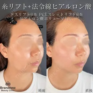 Brandnew Beauty Clinicの症例