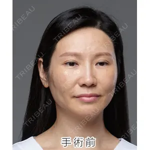 ジェア歯科 カン・ヨンホ医師の症例