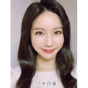 ジェア歯科 カン・ヨンホ医師の症例
